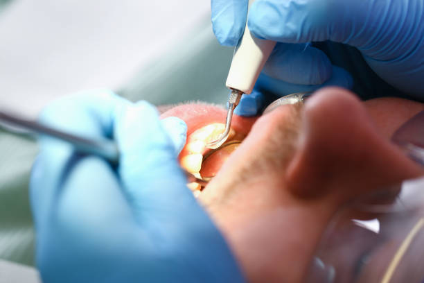 Best Broken Tooth Emergency  in Morrow, GA