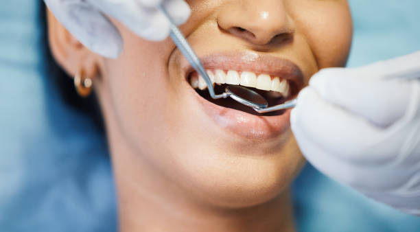 Urgent Tooth Repair in GA