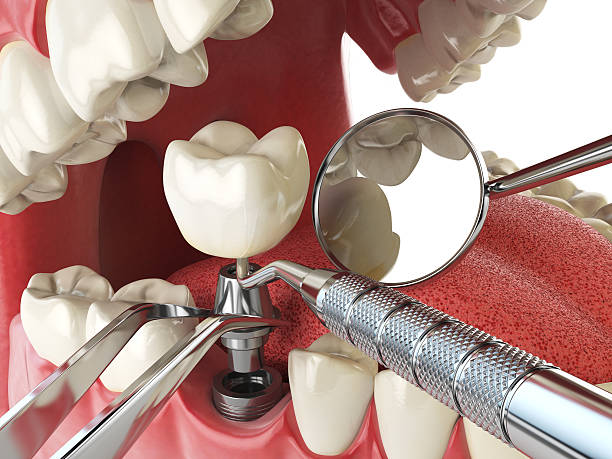 Best Cracked Tooth Emergency Dentist  in Morrow, GA